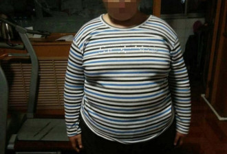 10岁男孩182斤坐着睡3年 母亲求救儿子一命