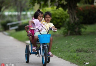 泰国连体姐妹花共享双腿 冒险分离不如快乐相伴