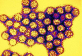 科学家发现一种可以注射的病毒 有效抗癌