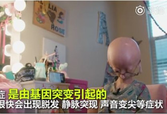 拥有1400万粉丝的网红，每天都在死亡倒计时