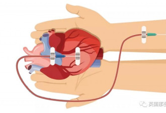 他们移植了同一人的器官，却患上癌症 防不胜防