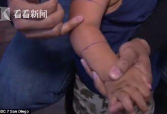 美国15月大男婴遭响尾蛇咬手 以为是会动的玩具