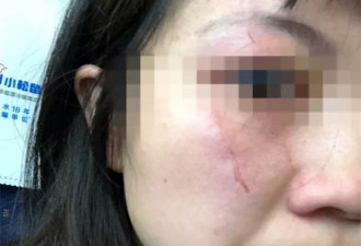 动车占座大妈抓伤劝让乘客：他们骂我不要脸