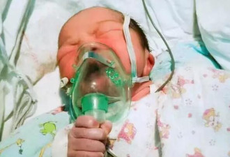 超励志！宝宝刚出生就手拿氧气罩吸氧