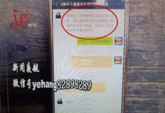 女子检测骨密度不显示数据 工作人员：太胖