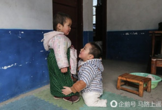 2年前病床上跳小苹果的男孩长大了 双腿截肢