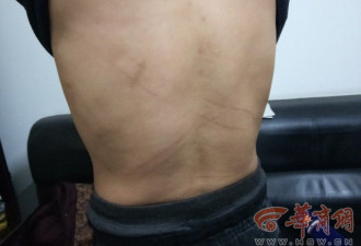 男子与女网友约炮后 遭其“丈夫”扒光扔野地