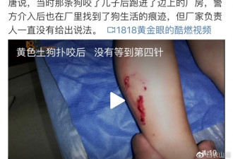 男孩被狗咬伤 打了3针狂犬疫苗还身亡？