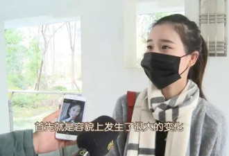 19岁少女整容失败假体从鼻子掉出