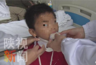 9岁女孩遭父亲吊起来打颈椎脱位 父亲:失手了