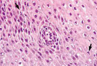 科学家成功用人源多能干细胞制成食管上皮细胞