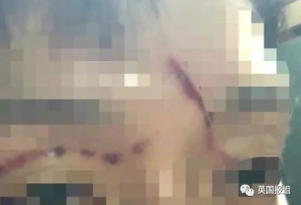 女星被家暴遭色情威胁：韩国人彻底怒了
