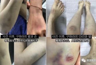 女星被家暴遭色情威胁：韩国人彻底怒了