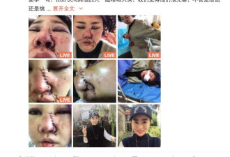 在丽江，还有多少游客被偷被骗被抢被打？