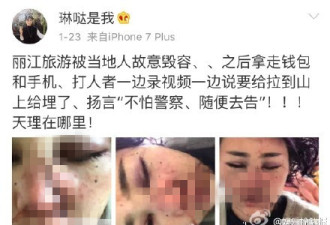 云南警方回应女子被毁容事件:系微伤 嫌犯被控