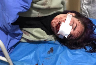 女游客称在丽江遭围殴 脸部被碎酒瓶毁容