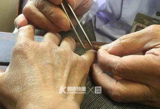 杭州名中医养几万只蜜蜂 病人每天排队等着被蜇