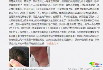 丽江回应“游客餐厅遭殴打”:5名嫌犯被拘罚款