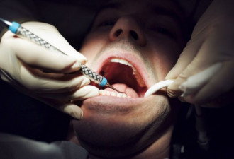 加拿大打工者的牙医保险要被征税 人均缴$1200