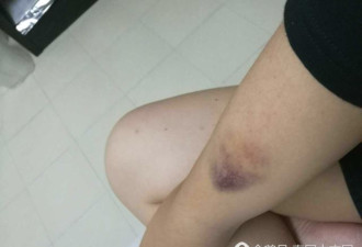 中国留学女生在泰国遭校园暴力 半夜被男生打