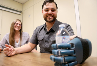 渥太华医院3D打印假肢成功