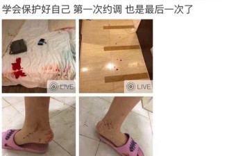 中国羽坛名将被曝涉SM丑闻 女生下体出血全裸