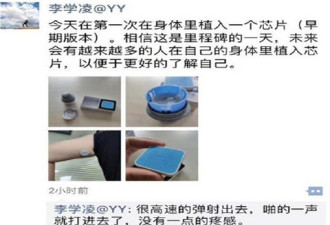 中国企业家YY CEO李学凌 自曝在体内植入芯片