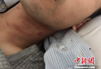 中国游客越南遭暴打：母亲被按玻璃上看儿被打