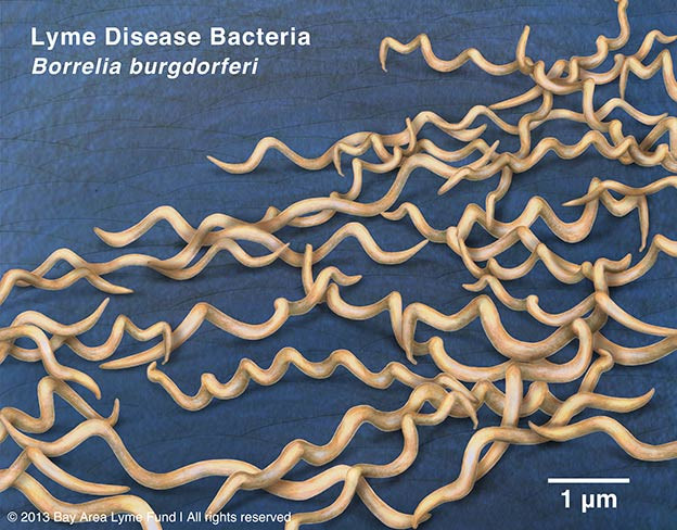 “Borrelia burgdorferi”的图片搜索结果