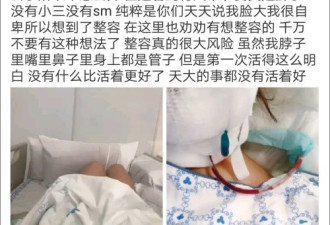 网红“洛丽塔大哥”削骨整容 被医生意外割喉