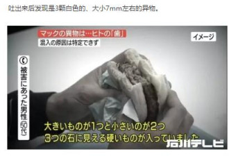 日本一麦当劳汉堡被吃出3颗人类牙齿 原因不明