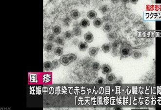 赴日旅游注意 日本爆发风疹患者已超过2000人