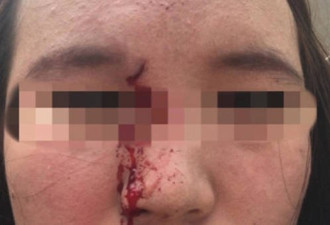 “滚出我的国家！” 悉尼华人女性当街遭袭