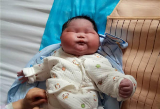 13.4斤巨大儿诞生！西安产妇生下超重宝宝