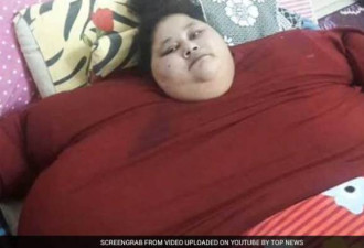 体重500公斤的世界最胖姑娘手术后露出微笑