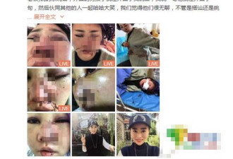 丽江被打毁容女游客：我面部囊肿 已无处下刀