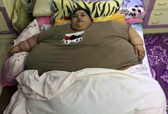 世界最胖女26天减重120公斤 曾起重机吊起送医