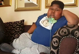 11岁男童患肥胖症去世 连卫生纸都吃