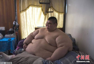 墨西哥男子体重曾达半吨 4个月减170公斤