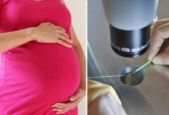 全球首例“三父母”婴儿细节公布: 细胞核移植