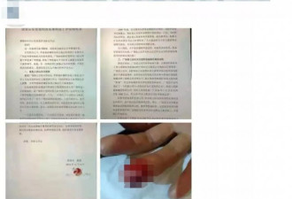 刹车片制造教父 妻子血书举报 山东多部门回应