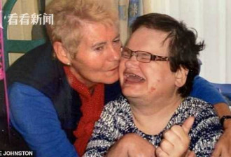 残障女子英国公立医院被拔掉满口牙 三周后死去