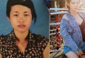 为男友生孩子后因丑被对方家人拒 她花3万整容