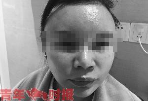 三女子花39万打美容针中毒 术后面部僵硬嘴角歪