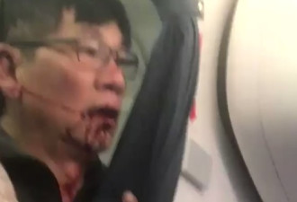 美联航华裔被打事件:航空公司称因机组人员调动