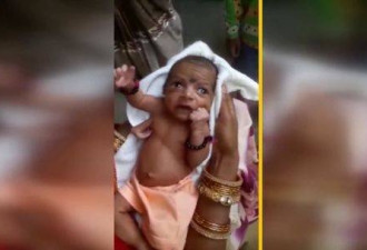 印度女婴生下来就有三只手 被当做神一样崇拜