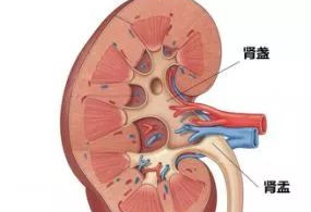 9岁娃肾里取出56颗结石 原来他只吃这些东西