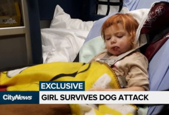 3岁女童遭恶犬咬  妈妈目睹全程尖叫痛哭