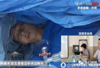 29岁男子开颅手术中突然苏醒 与医生淡定交谈