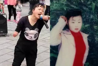 残疾卖唱女: 生来就没手脚 现在都不敢出门